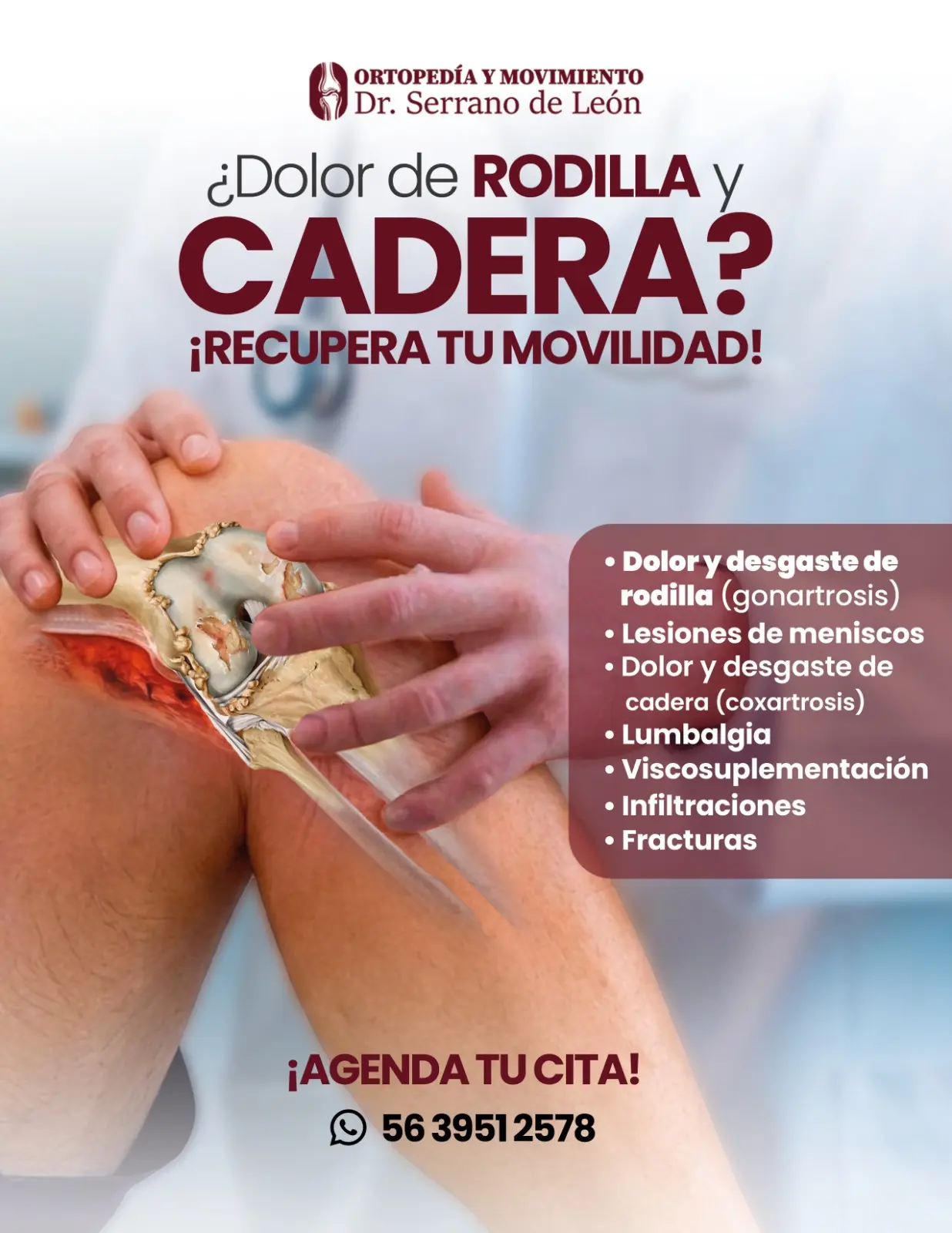 Preguntas frecuentes - Dr. Luis Alfonso Serrano